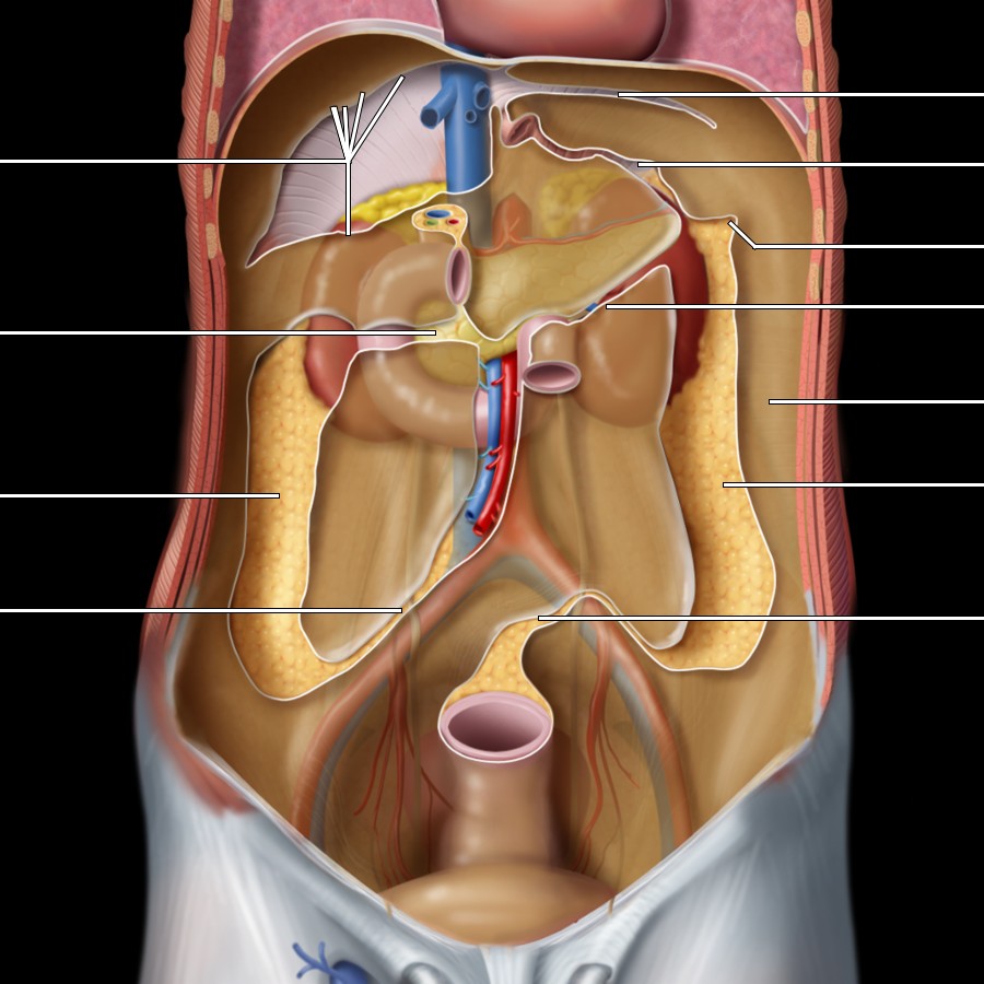 Frontal graphic shows the abdomen with all of the intraperitoneal organs removed. The root of the transverse mesocolon divides the peritoneal cavity into supramesocolic and inframesocolic spaces that communicate only along the paracolic gutters. The coronary and triangular ligaments suspend the liver from the diaphragm. The superior mesenteric vessels traverse the small bowel mesentery whose root crosses obliquely from the upper left to the lower right posterior abdominal wall.