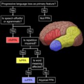 A diagnostic decision tree for clinical diagnosis of primary progressive aphasia (PPA) subtypes is shown along with a 3D surface rendering of an FDG brain PET, indicating key areas of involvement in each PPA subtype: Nonfluent-variant PPA (nfvPPA), logopenic-variant PPA (lvPPA), semantic-variant PPA (svPPA).