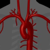 Graphic depicts the thoracic aorta and great vessel origins.