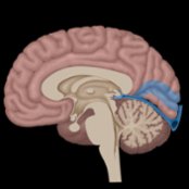 Sagittal graphic of the brain depicts the territory of the primary visual cortex in the occipital lobe along the banks of the calcarine sulcus (blue) that is decreased in Lewy body dementia (LBD) on F-18 FDG PET.