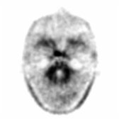 More inferior axial F-18 florbetapir PET in a normal exam also demonstrates clear cerebellar gray  and white  differentiation.