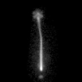 Posterior radionuclide cisternography in a normal patient immediately after lumbar puncture and injection of radiotracer confirms intrathecal placement . Basilar cisterns  are evident.
