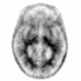 More inferior axial F-18 florbetapir PET in a normal exam shows characteristic uptake in the white matter  but no significant uptake extending in the gray matter , indicating no detectable amyloid deposition.