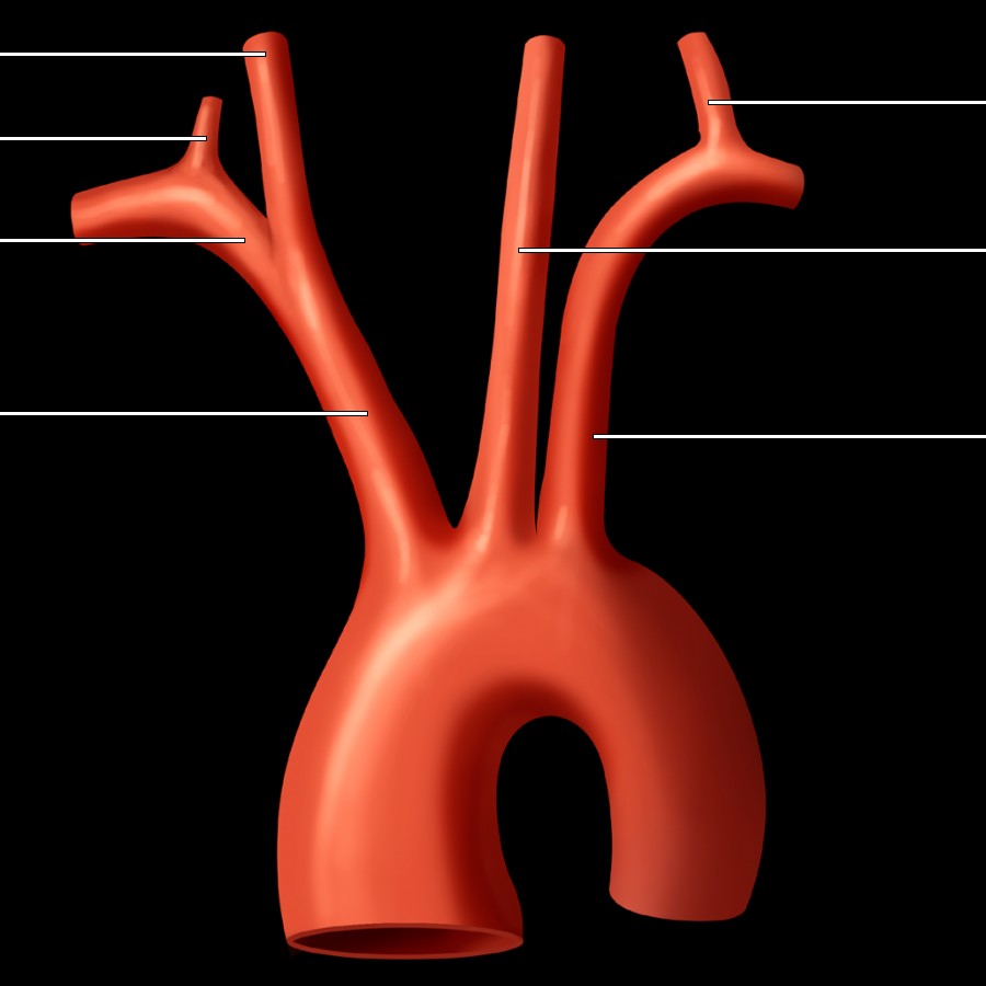 Graphic depicts the most common configuration of the aortic arch, the 3-vessel arch.