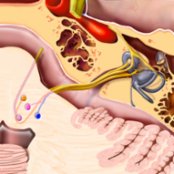 Axial graphic shows CNVII nuclei. The motor nucleus sends out its fibers to circle the CNVI nucleus before reaching the root exit zone at the pontomedullary junction. The superior salivatory nucleus sends parasympathetic secretomotor fibers to the lacrimal, submandibular, and sublingual glands. The solitary tract nucleus receives taste information from the anterior 2/3 of the tongue.