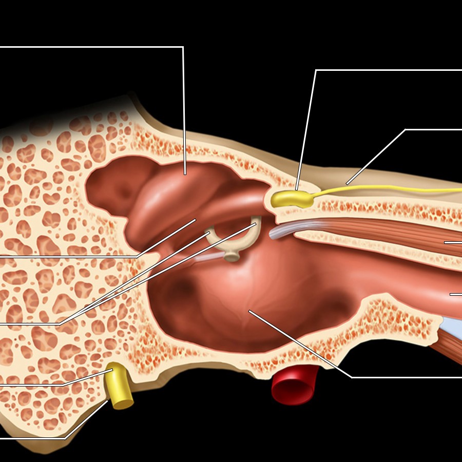 Sagittal graphic shows the medial wall of the middle ear. Note craniocaudal orientation of the lateral semicircular canal (LSCC), facial nerve (tympanic segment), oval window (stapes footplate attaches to oval window), and cochlear promontory (bony bulge covering the basal turn of cochlea). Greater superficial petrosal nerve (GSPN) originates at geniculate ganglion in the anterior genu of the facial nerve, where the nervus intermedius of Wrisberg [(NIW) not shown] joins the facial nerve. Posteroinferiorly, the descending mastoid segment of the facial nerve exits the temporal bone at the stylomastoid foramen on its way to the parotid gland.