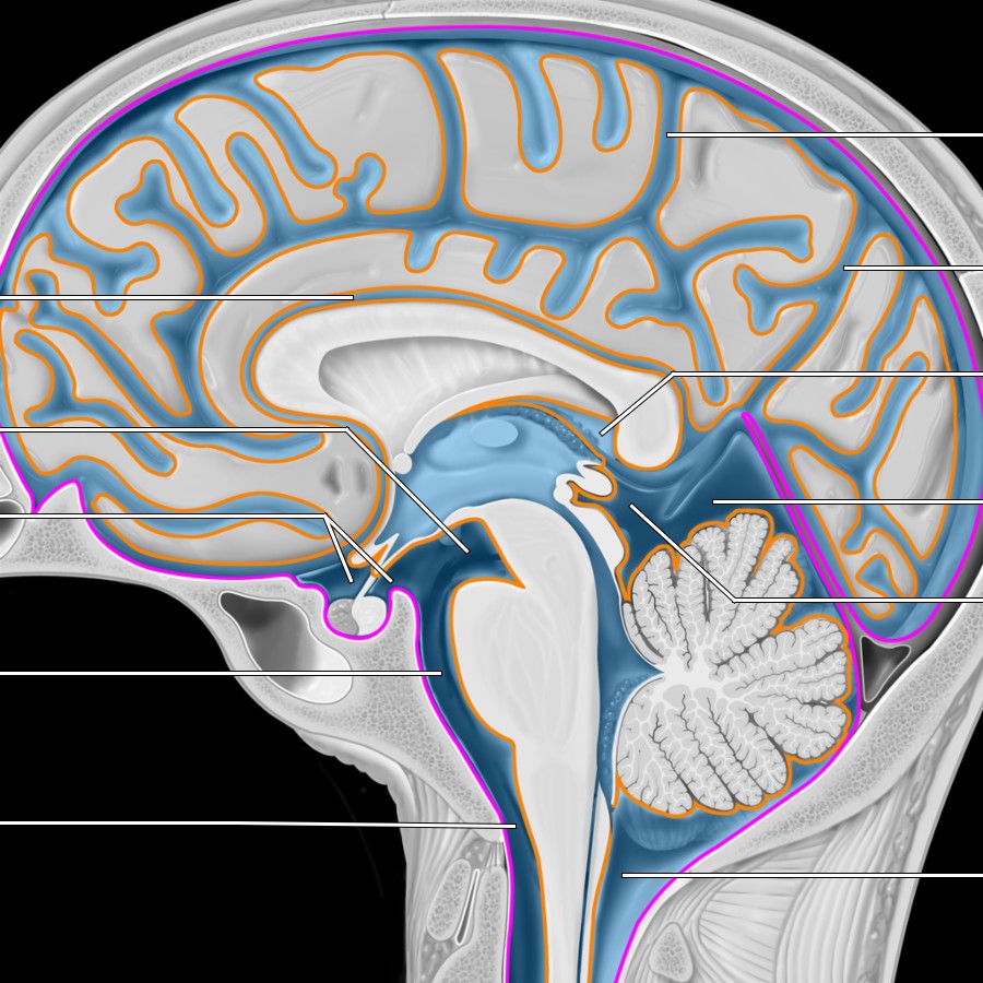 Sagittal midline graphic through the interhemispheric fissure depicts the subarachnoid spaces (SASs) with CSF (blue) between the arachnoid (purple) and pia (orange). The central sulcus separates the frontal lobe (anterior) from the parietal lobe (posterior). The pia mater is closely applied to the brain surface, whereas the arachnoid is adherent to the dura. The ventricles communicate with the cisterns and SAS via the foramina of Luschka and Magendie. The cisterns normally communicate freely with each other.