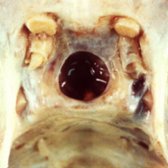 Axial gross pathology shows a primary empty sella found incidentally at autopsy. Note the wide opening of the diaphragma sellae  and CSF  largely filling the bony sella. (Courtesy M. Sage, MD.)