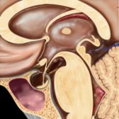 Sagittal graphic shows an empty sella (ES). The extension of arachnoid with CSF through the diaphragma sellae  flattens and displaces the pituitary gland  posteroinferiorly against the sellar floor.