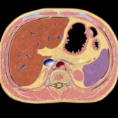 The right adrenal is often more cephalic in location and lies above the right kidney, while the left adrenal lies partly in front of the upper pole of the left kidney. The left adrenal lies directly posterior to the splenic vein and body of pancreas and lateral to the left crus of the diaphragm. The right adrenal lies lateral to the crus, medial to the liver, and directly behind the IVC.