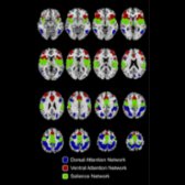 Subnetworks of the attention control network are shown. The mask of attention control network regions was obtained from brain voxels correlated with r > 0.15 to 4 seeds in the bilateral intraparietal sulcus and bilateral superior insula in 1,353 subjects. Functional connectivity was calculated for each voxel within this mask to 7,266 gray matter regions, and voxels were parcellated into 3 clusters using a k-means algorithm based on similar connectivity to the rest of the brain. The voxels in blue show characteristic distribution of the dorsal attention network, including frontal eye fields, intraparietal sulcus, and middle temporal areas. The voxels in green show characteristic distribution of the salience network, including insula and dorsal anterior cingulate areas. The voxels in red show a distribution most consistent with the ventral attention network, including dorsolateral prefrontal, inferior frontal, ventral anterior cingulate, and supramarginal gyrus areas.