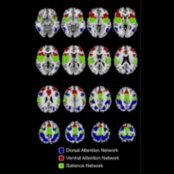 Subnetworks of the attention control network are shown. The mask of attention control network regions was obtained from brain voxels correlated with r > 0.15 to 4 seeds in the bilateral intraparietal sulcus and bilateral superior insula in 1,353 subjects. Functional connectivity was calculated for each voxel within this mask to 7,266 gray matter regions, and voxels were parcellated into 3 clusters using a k-means algorithm based on similar connectivity to the rest of the brain. The voxels in blue show characteristic distribution of the dorsal attention network, including frontal eye fields, intraparietal sulcus, and middle temporal areas. The voxels in green show characteristic distribution of the salience network, including insula and dorsal anterior cingulate areas. The voxels in red show a distribution most consistent with the ventral attention network, including dorsolateral prefrontal, inferior frontal, ventral anterior cingulate, and supramarginal gyrus areas.