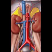 The adrenal glands rest atop the kidneys with an interposed layer of fat. Reflecting their critical role in maintaining homeostasis and responding to stress, the adrenal glands have a very rich vascular supply. The superior adrenal arteries are short branches of the inferior phrenic arteries bilaterally. The middle adrenal arteries are short vessels arising from the aorta. The inferior adrenal arteries are branches of the renal arteries. The left adrenal vein drains into the left renal vein, while the right adrenal vein drains directly into the inferior vena cava (IVC). Note the size of the adrenal glands is somewhat exaggerated in this graphic to facilitate demonstration of the vascular anatomy.