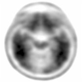 More inferior axial F-18 florbetapir PET in the same patient shows homogeneous uptake throughout the brain without clear distinction between gray
and white
matter in the temporal lobe, consistent with heavy Aβ deposition in the gray matter, which is seen in AD.