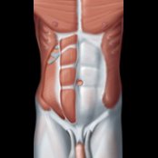Graphic shows the aponeuroses of the internal and external oblique and transverse abdominal muscles are 2 layered and interweave with each other, covering the rectus muscle and constituting the rectus sheath and linea alba. About midway between the umbilicus and symphysis, at the arcuate line, the posterior rectus sheath ends (arcuate line), and the transversalis fascia is the only structure between the rectus muscle and parietal peritoneum.